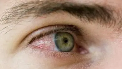 ارتفاع ضغط العين العلامات التحذيرية واسباب احمرارها