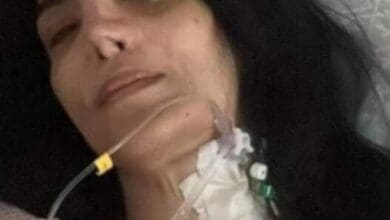 حقيقة وفاة حورية فرغلي ..بعد استئصال الرحم لوجود 9 اورام